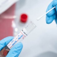 Prestanak testiranja na virus SARS-COV-2 u sjedištu Zavoda